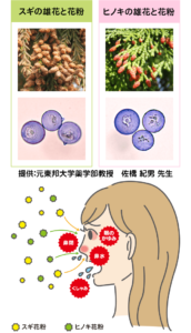 スギ花粉とヒノキ花粉